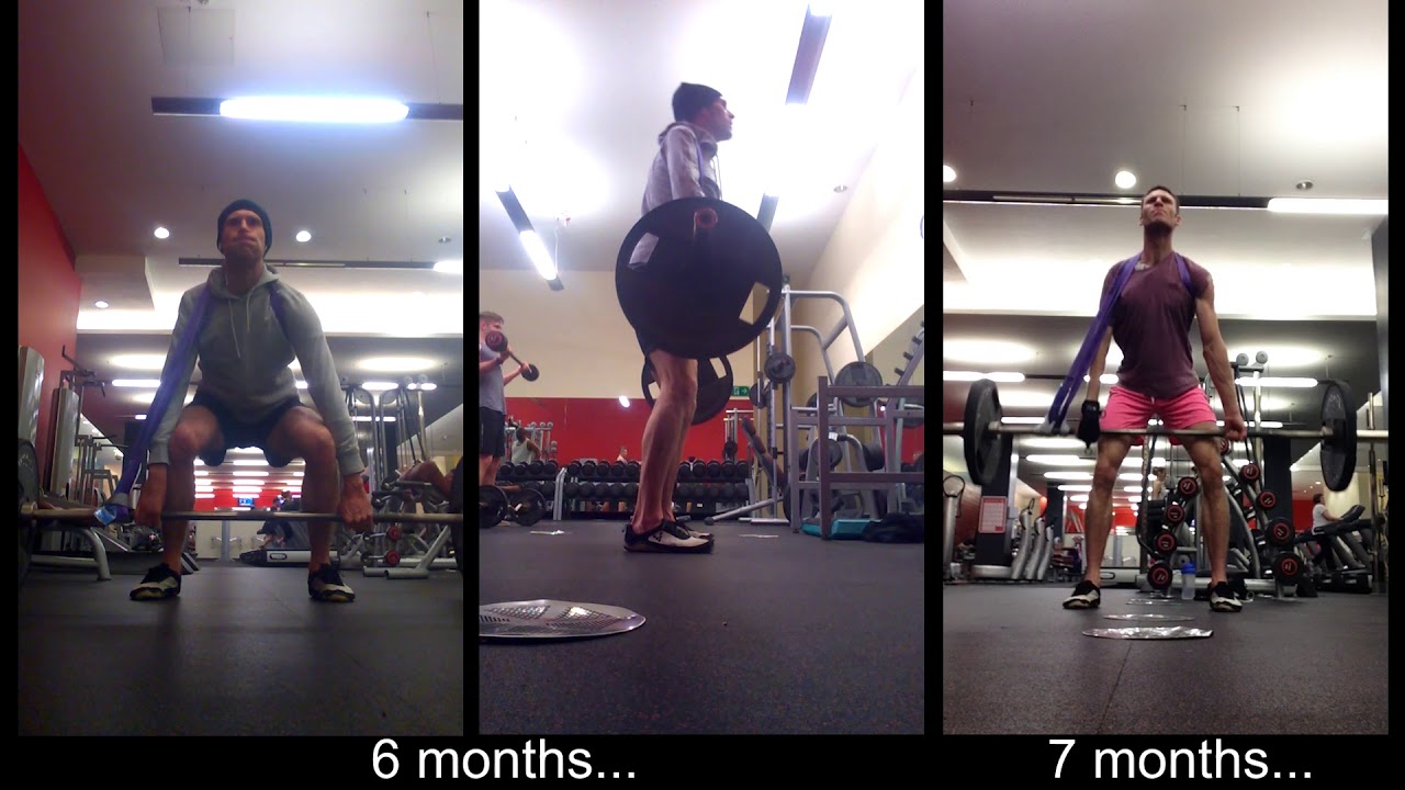 Brachial Plexus Deadlift