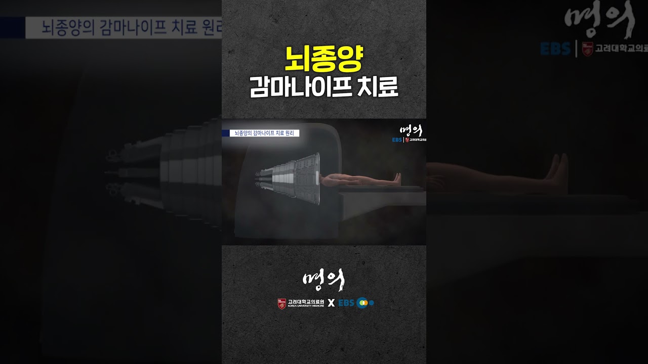 칼 안대고 뇌종양 치료! 감마나이프 수술