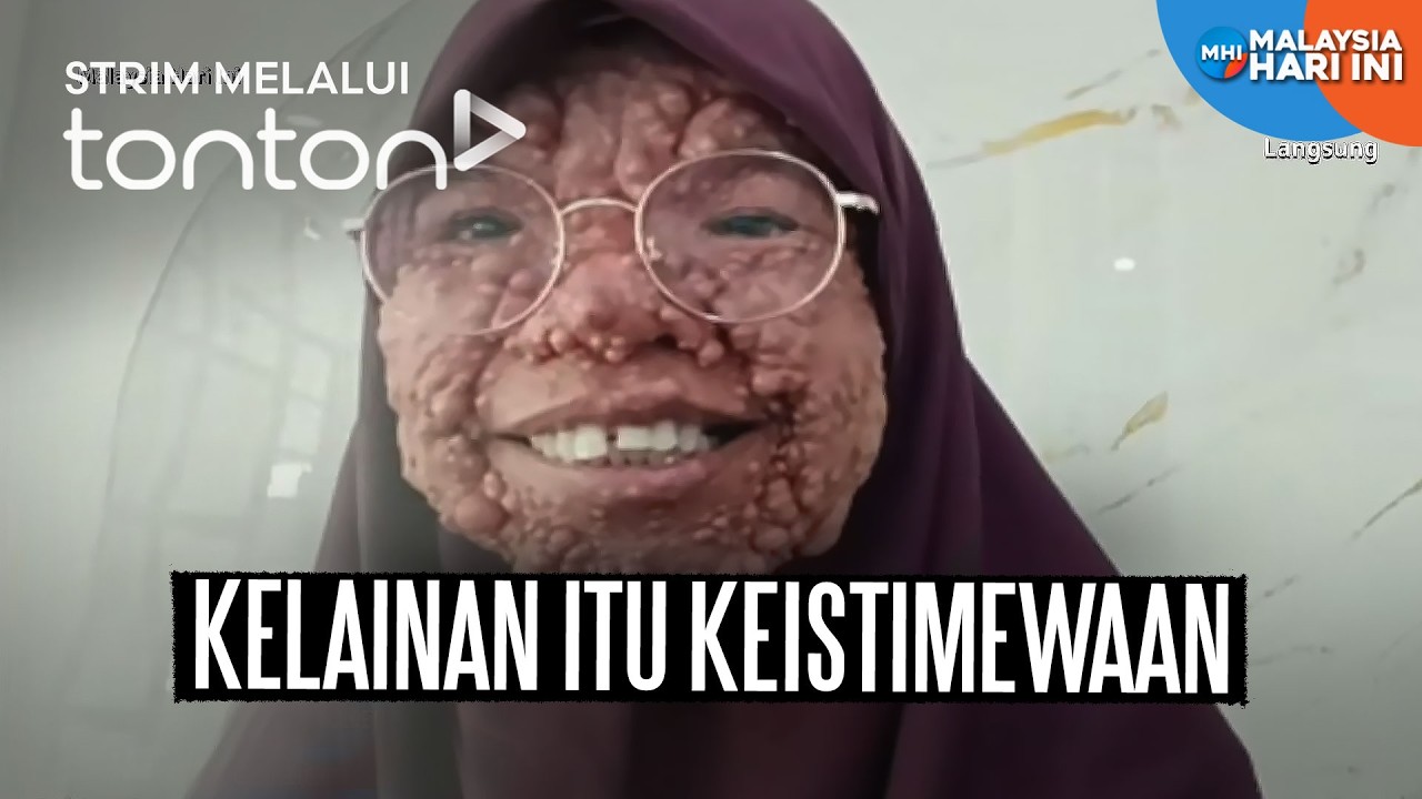 [CLIP] MHI (25 Feb 2026): Kelainan Itu Keistimewaan | Tonton