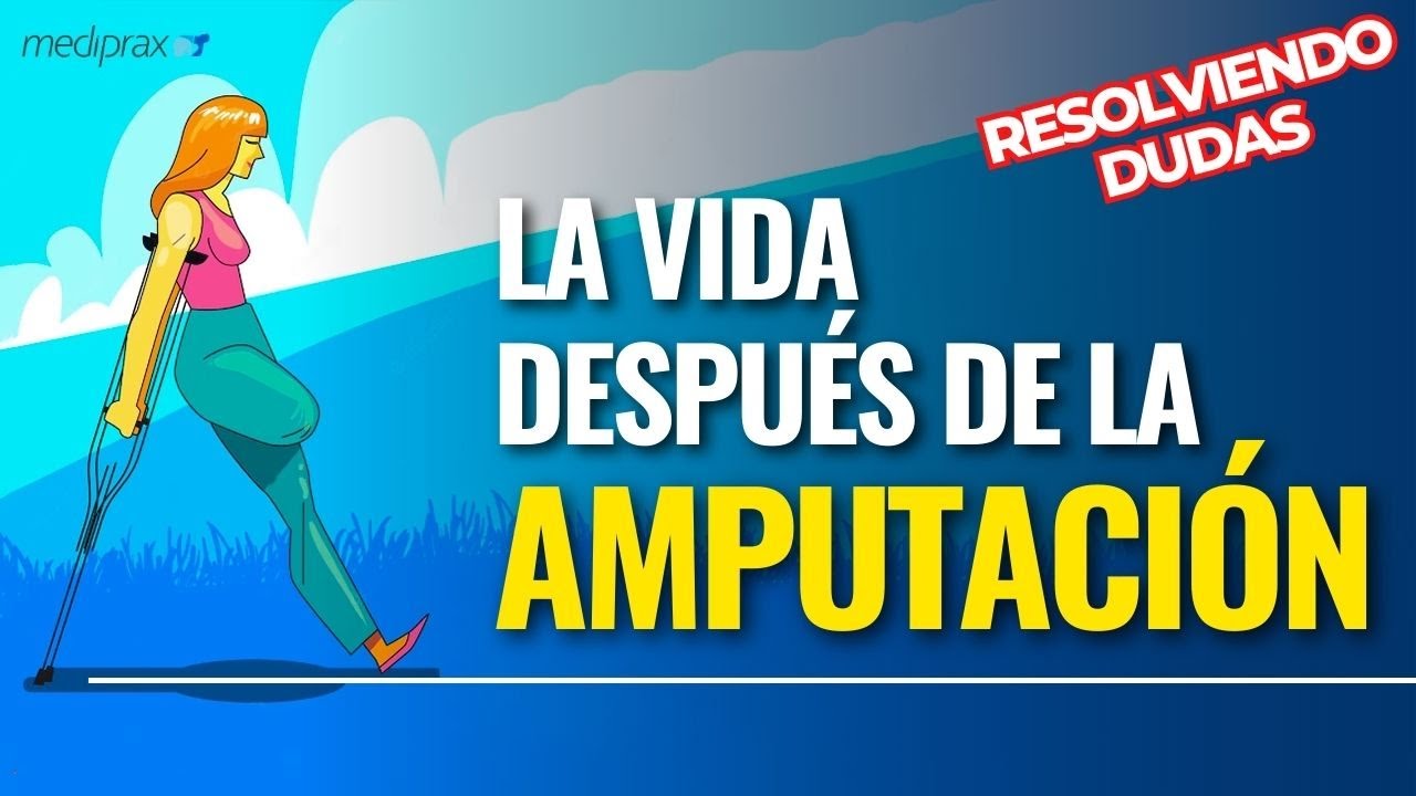 Preguntas frecuentes de un reci&eacute;n amputado: Aclarando tus inquietudes👨&zwj;⚕️