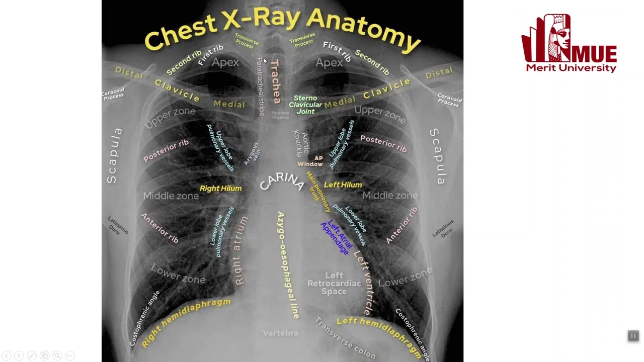 RADIOLOGY 1- CHEST TRAUMA IMAGING - 2 DEC 2025