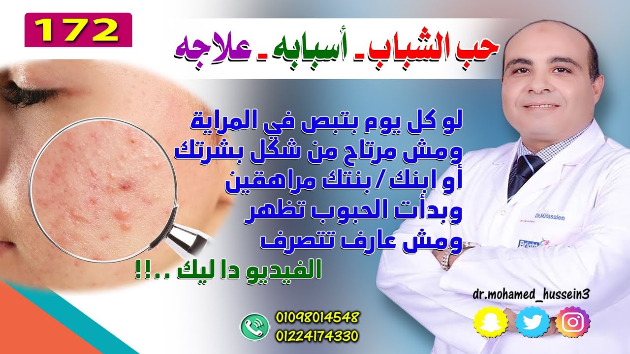 حب الشباب - أسبابه - علاجه - للدكتور محمد حسين - 172