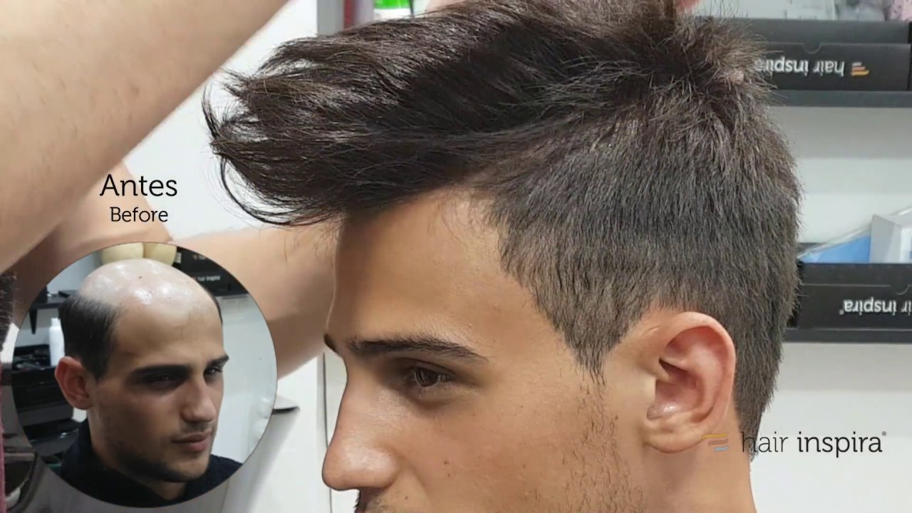 Hair Replacement fitting video (Alex) part 2 – Hair lnspira