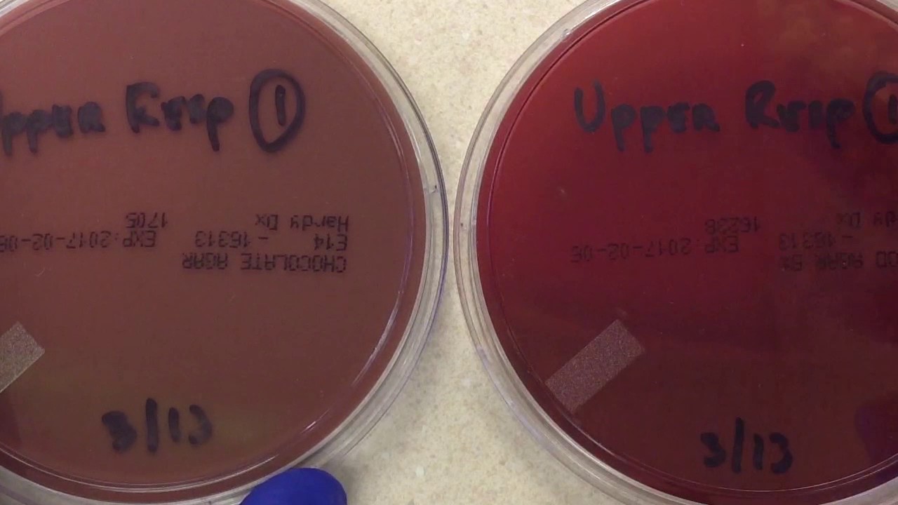 Plate Reading - Upper Respiratory I
