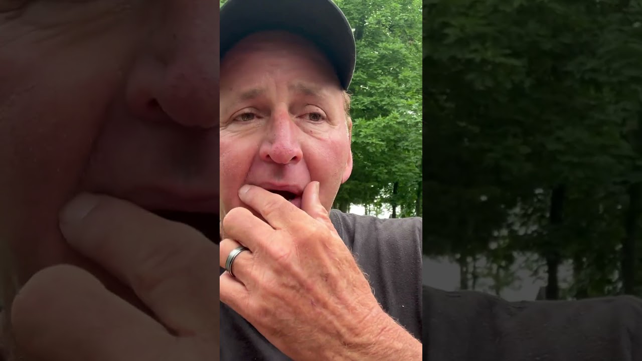 Side Imaging Technology Sucks