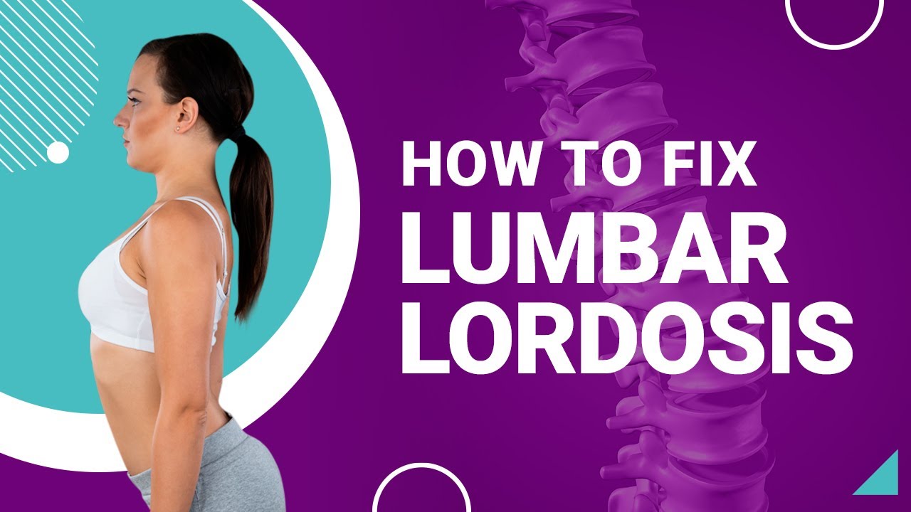 How to Fix Lumbar Lordosis