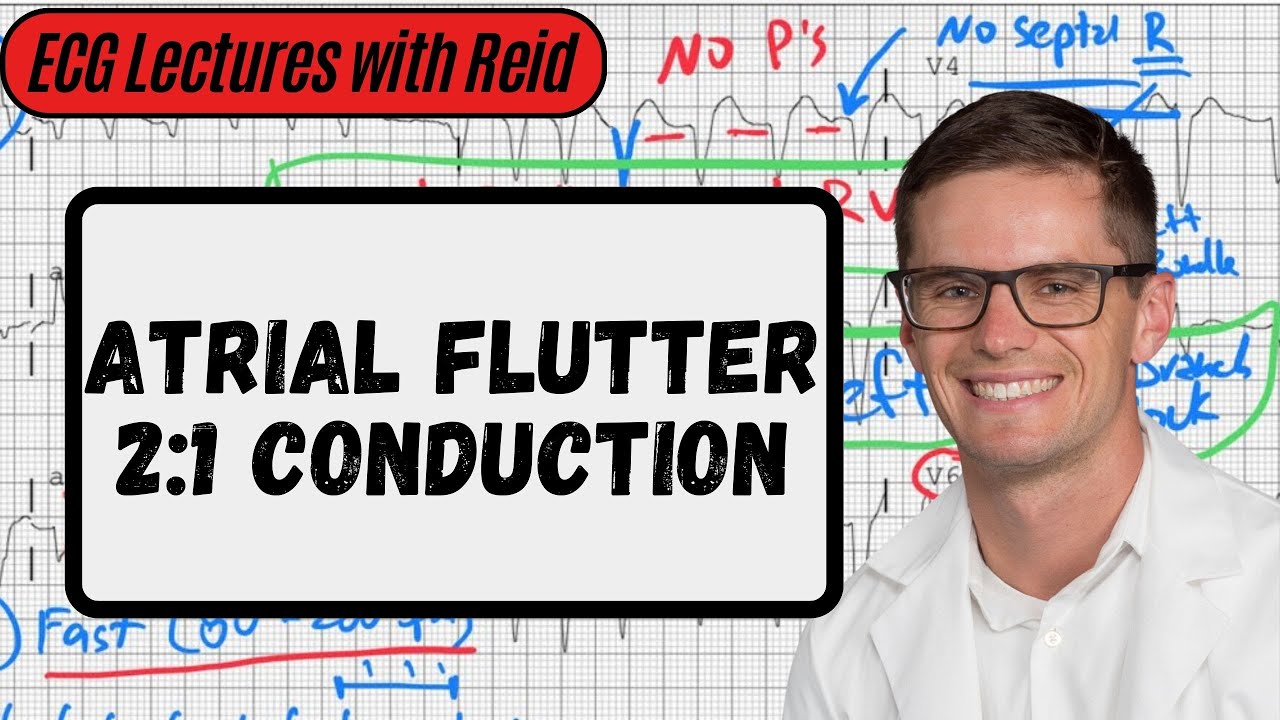 2:1 Atrial Flutter | Day 12 ECG Challenge