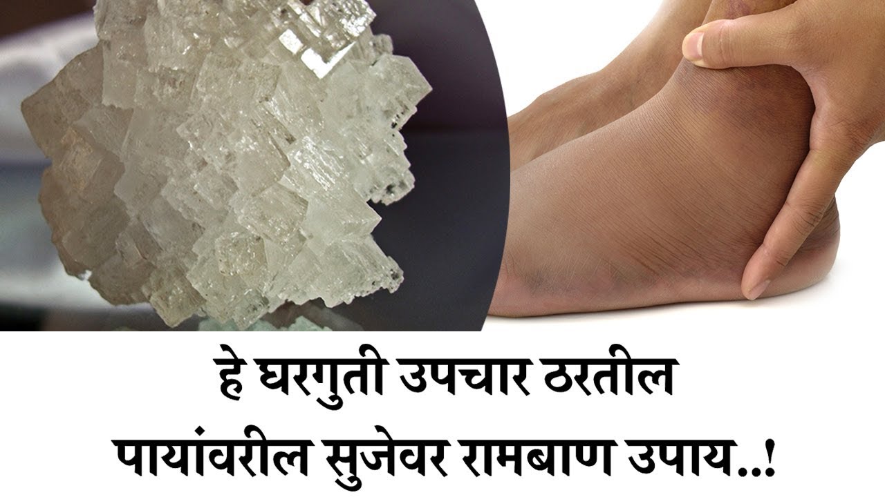 हे घरगुती उपचार ठरतील पायांवरील सुजेवर रामबाण उपाय | Maharashtra Times