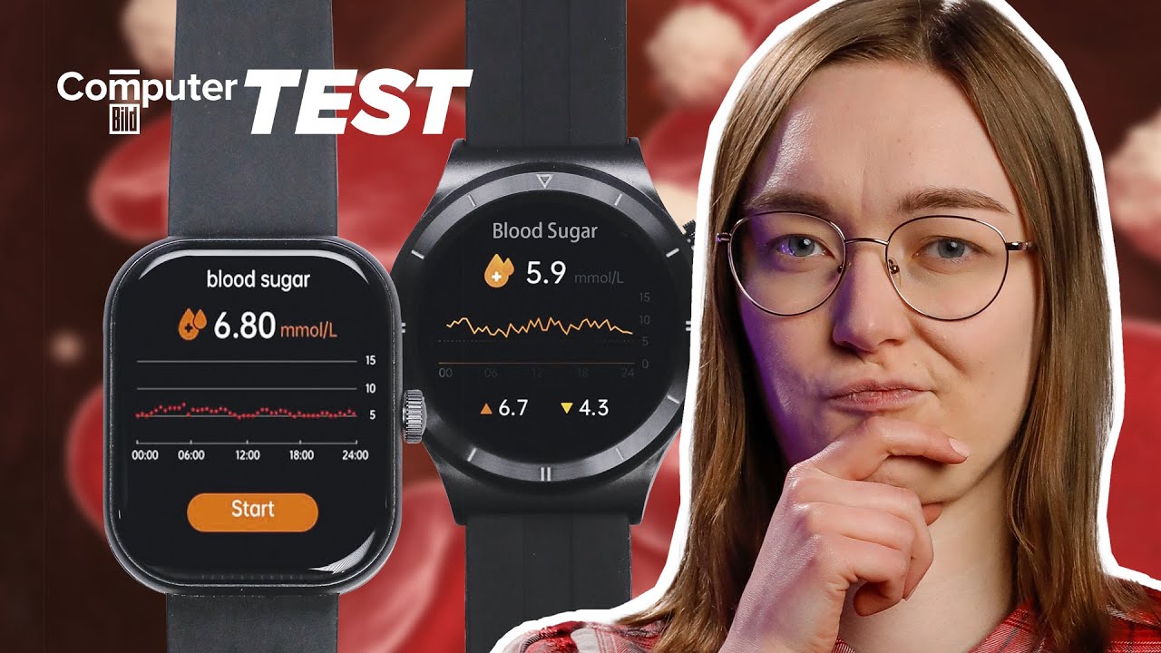 Blutzucker per Smartwatch messen: Geht es schon ohne Pieks?