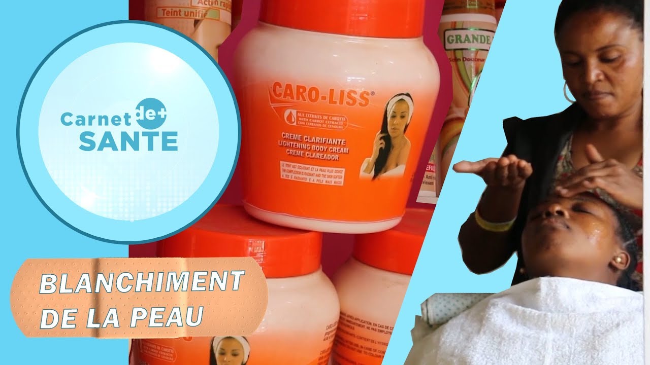 Carnet de Santé | La dépigmentation volontaire ou le blanchiment de la peau
