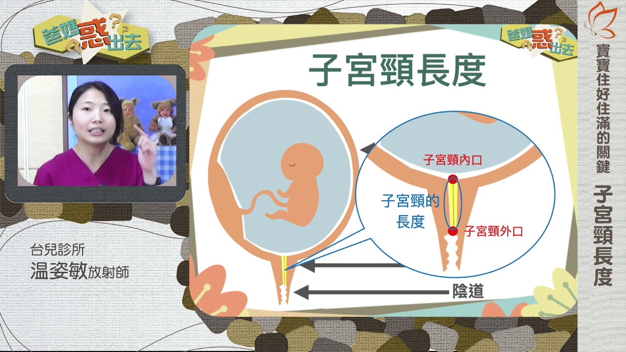 子宮頸長度01：子宮頸長度的重要性（温姿敏放射師）