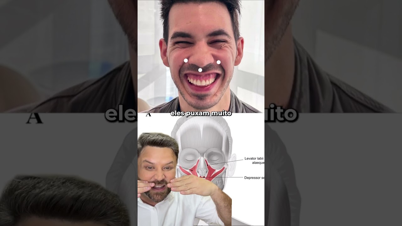 SORRISO GENGIVAL – sem cirurgia!
