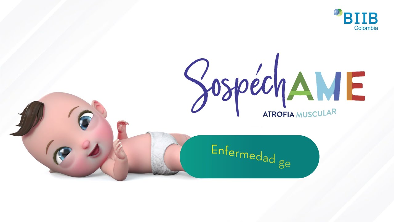 atrofia muscular espinal Tipo 1