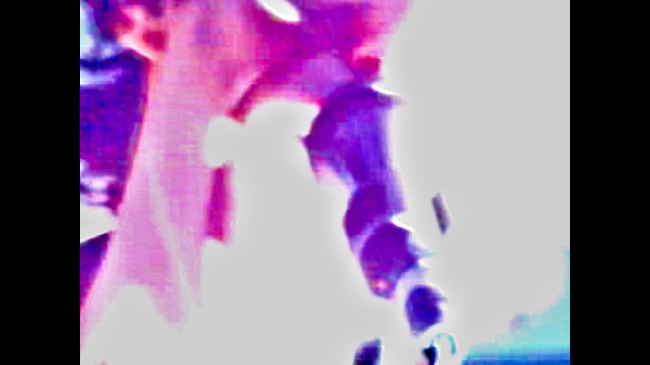 VOYEUR