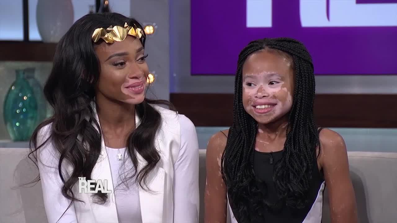 Winnie Harlow Meets April Star!