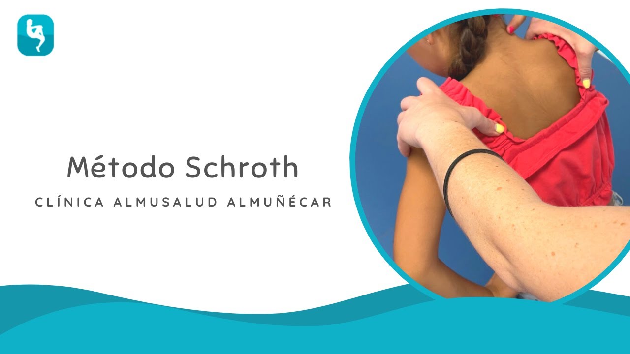 Método Schroth. ¿Cómo tratar la #escoliosis? Clínicas Almusalud