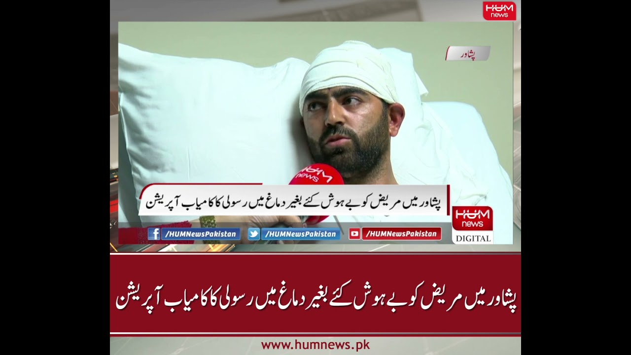 Successful rare brain tumour surgery performed in Peshawar