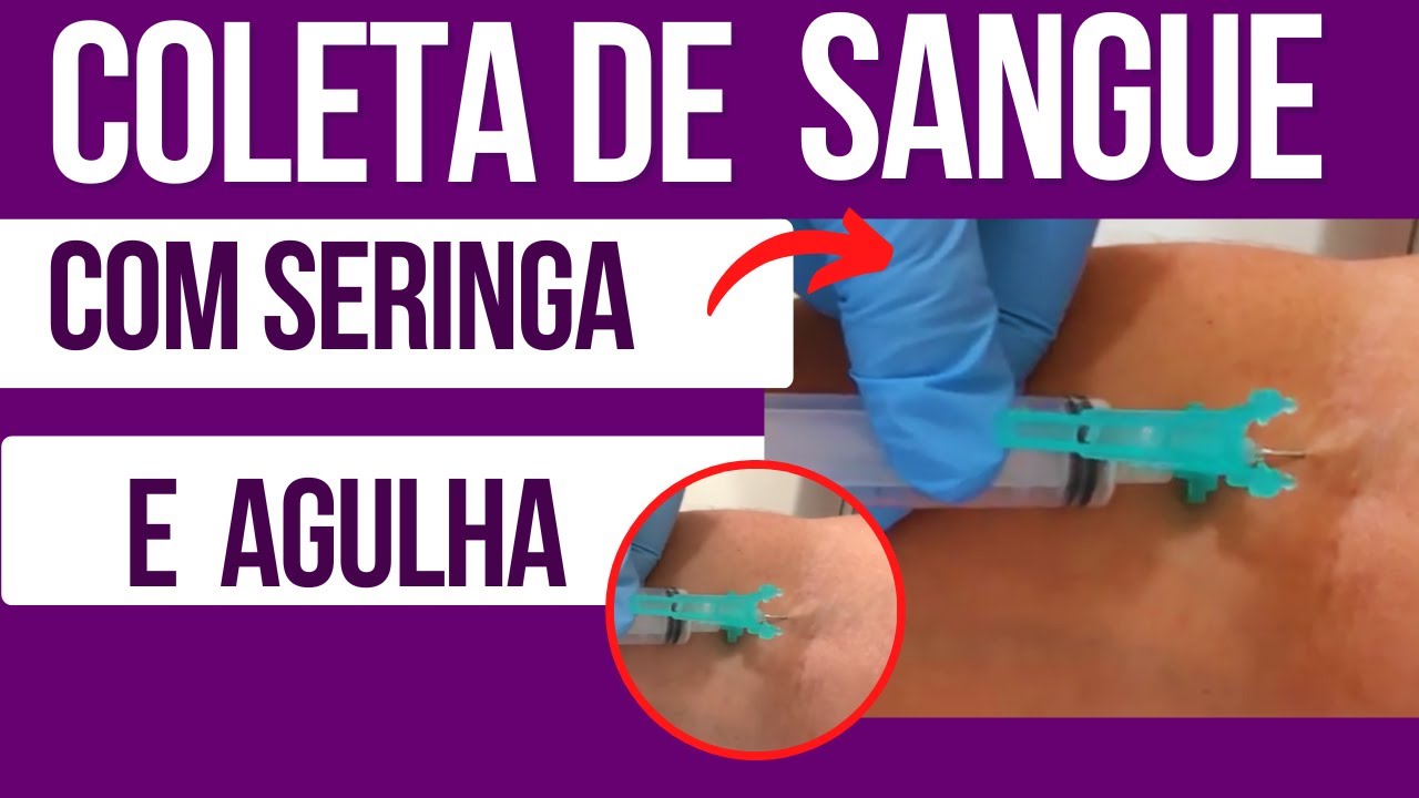 PUN&Ccedil;&Atilde;O VENOSA com Seringa e Agulha: Evite ESSE ERRO Cr&iacute;tico que NINGU&Eacute;M te conta!