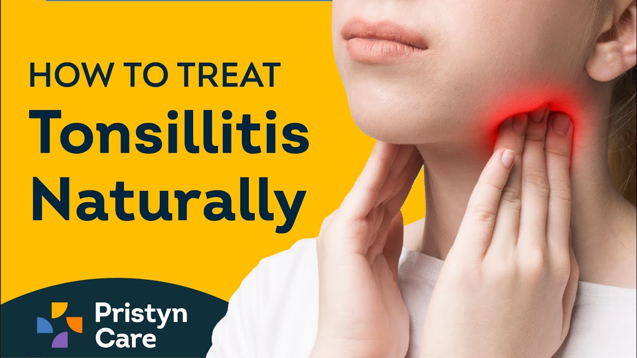 How to Treat Tonsillitis | Home remedies for Tonsillitis