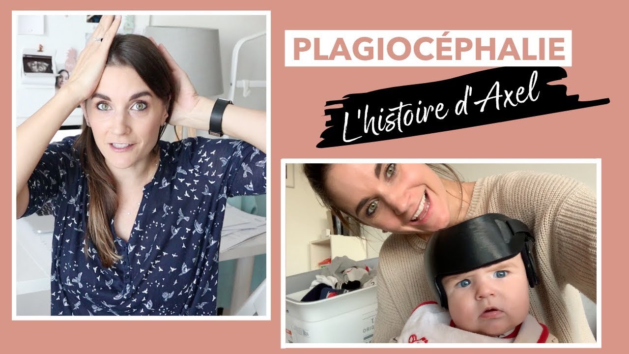 Plagiocéphalie et casque!