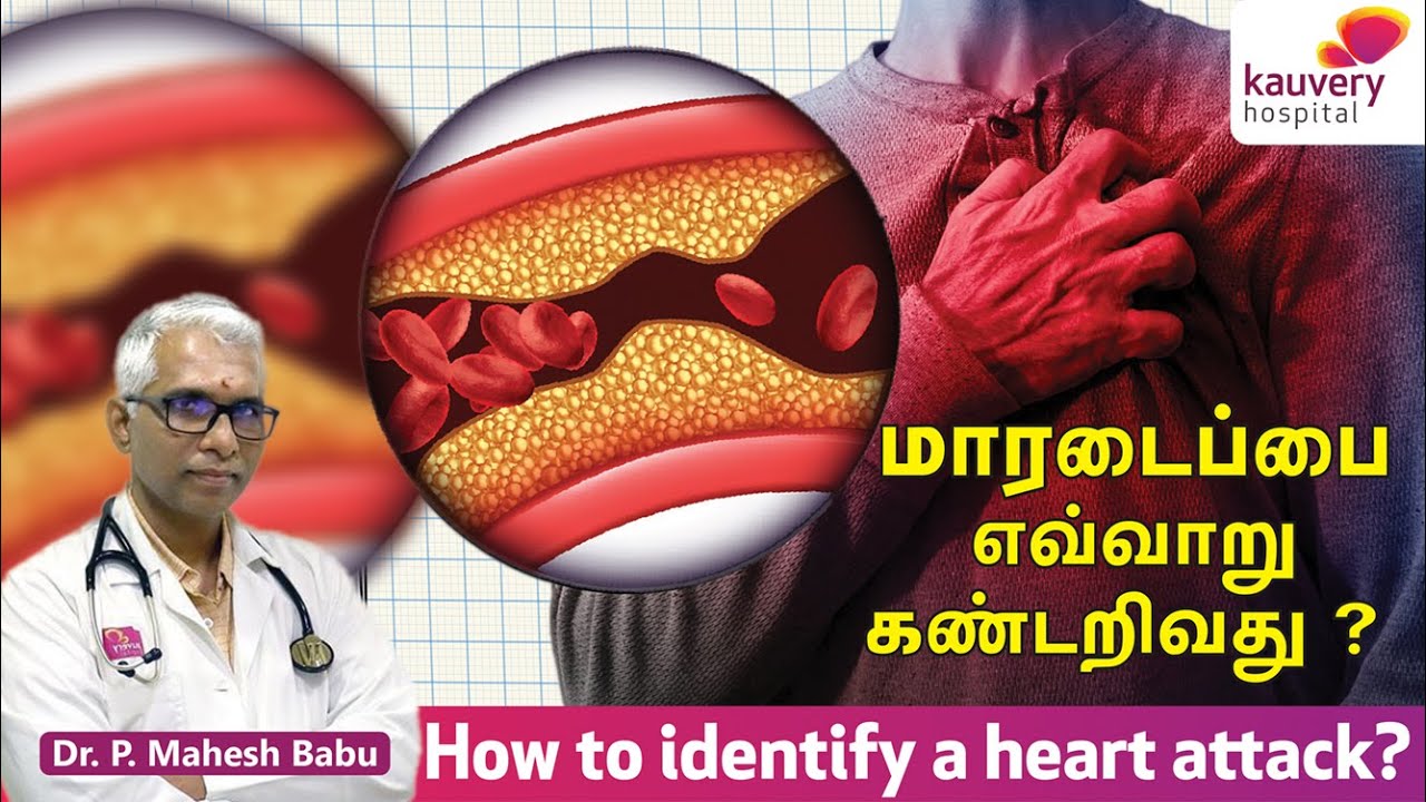 How to identify a heart attack? | மாரடைப்பை எவ்வாறு கண்டறிவது?