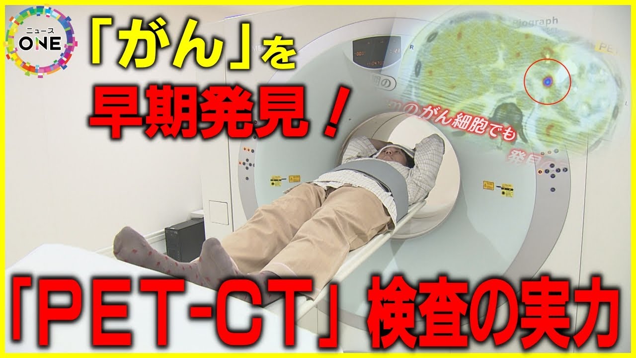 &ldquo;沈黙の臓器&rdquo;にも有効&hellip;がん早期発見で成果『PET-CT検査』のメリットと課題 医師「がんを死なない病気に」