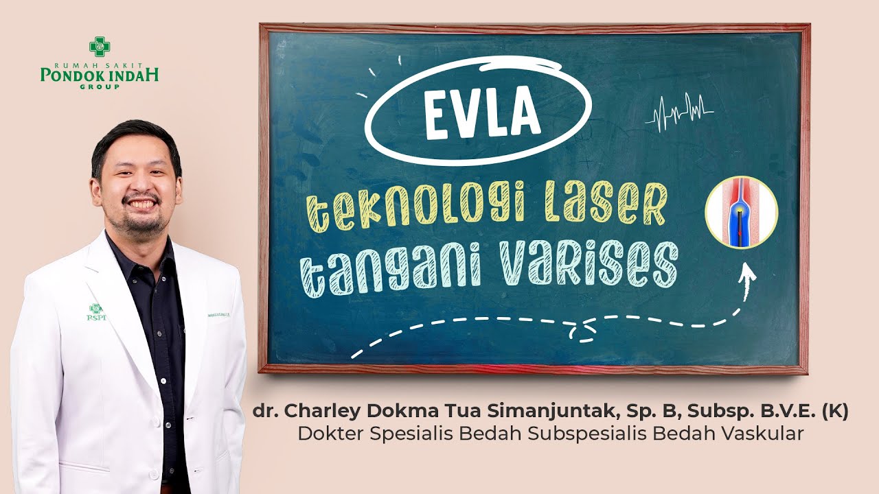 EVLA: Mengatasi Varises dengan Laser &ndash; dr. Charley Dokma Tua Simanjuntak, Sp. B, Subsp. B.V.E (K)