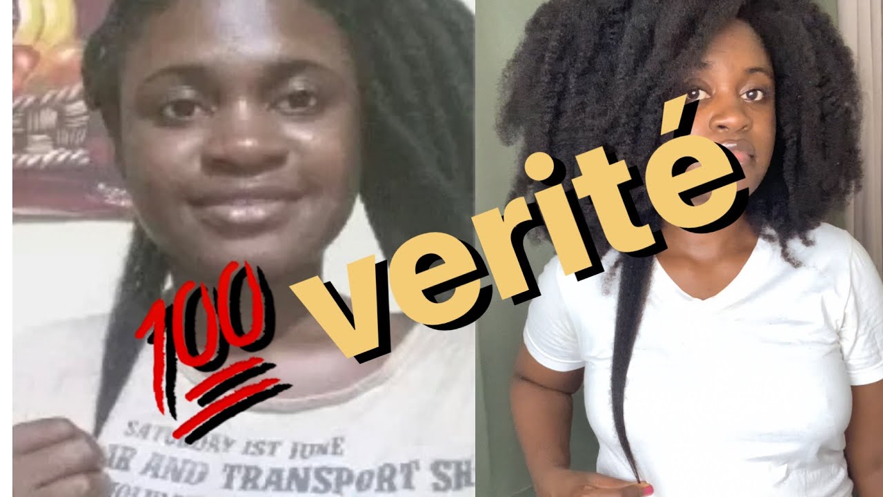 Tretman sa ap baw bò tèt, lap baw chevé long, chevé founi, menm pafouten lap baw.