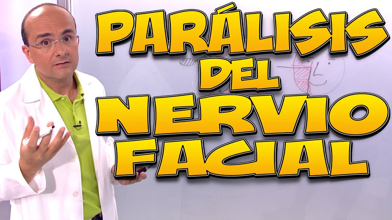 PAR&Aacute;LISIS del NERVIO FACIAL, Qu&eacute; es, CAUSAS, tipos, S&Iacute;NTOMAS, DIAGN&Oacute;STICO y TRATAMIENTO