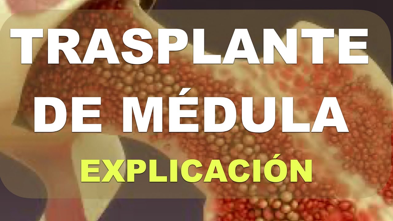 Qué es el 