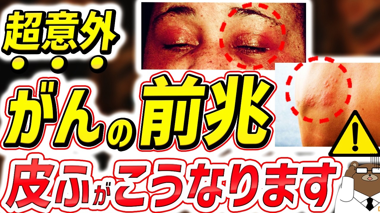 放置厳禁！知らないと後悔する皮膚のブツブツの「がん」のサイン。発疹・じんましん・かゆみ..絶対に見逃してはいけない意外な兆候とは？がんリスクの高い皮膚症状の見分け方とは。医師が徹底解説！