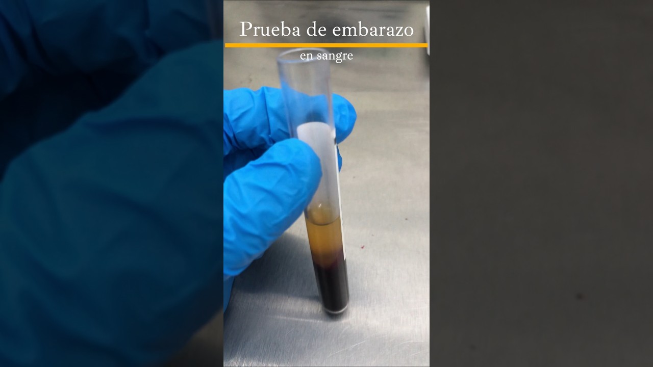 Cómo se lee una prueba de embarazo en sangre? #tutorial #embarazo #embarazada