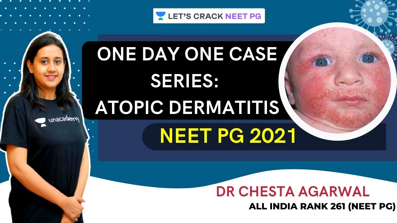 One Day One Case Series: Atopic Dermatitis | Dermatology | NEET PG 2021 | Dr. Chesta Agarwal