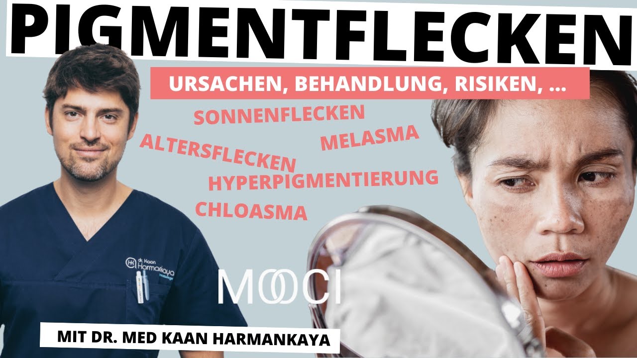 Pigmentflecken entfernen - Ursachen, Behandlung, Risiken