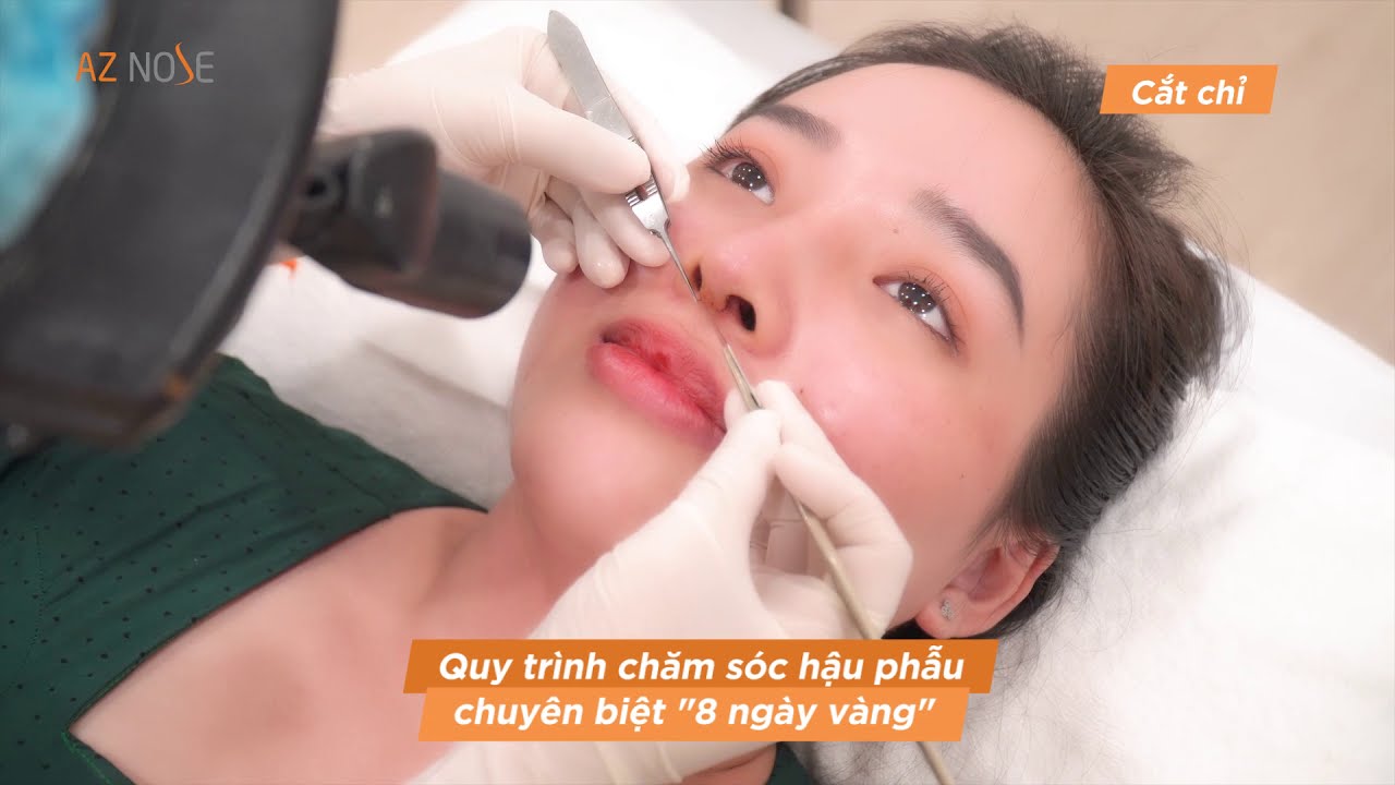 Về AZ NOSE|Những ĐẶC QUYỀN chắc chắn 100% kh&aacute;ch h&agrave;ng sẽ được trải nghiệm