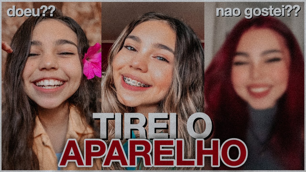 OLHA MEU ANTES E DEPOIS DO APARELHO - ENT&Atilde;O ROBERTA FAMILY siga @dailyfamiliaporcides