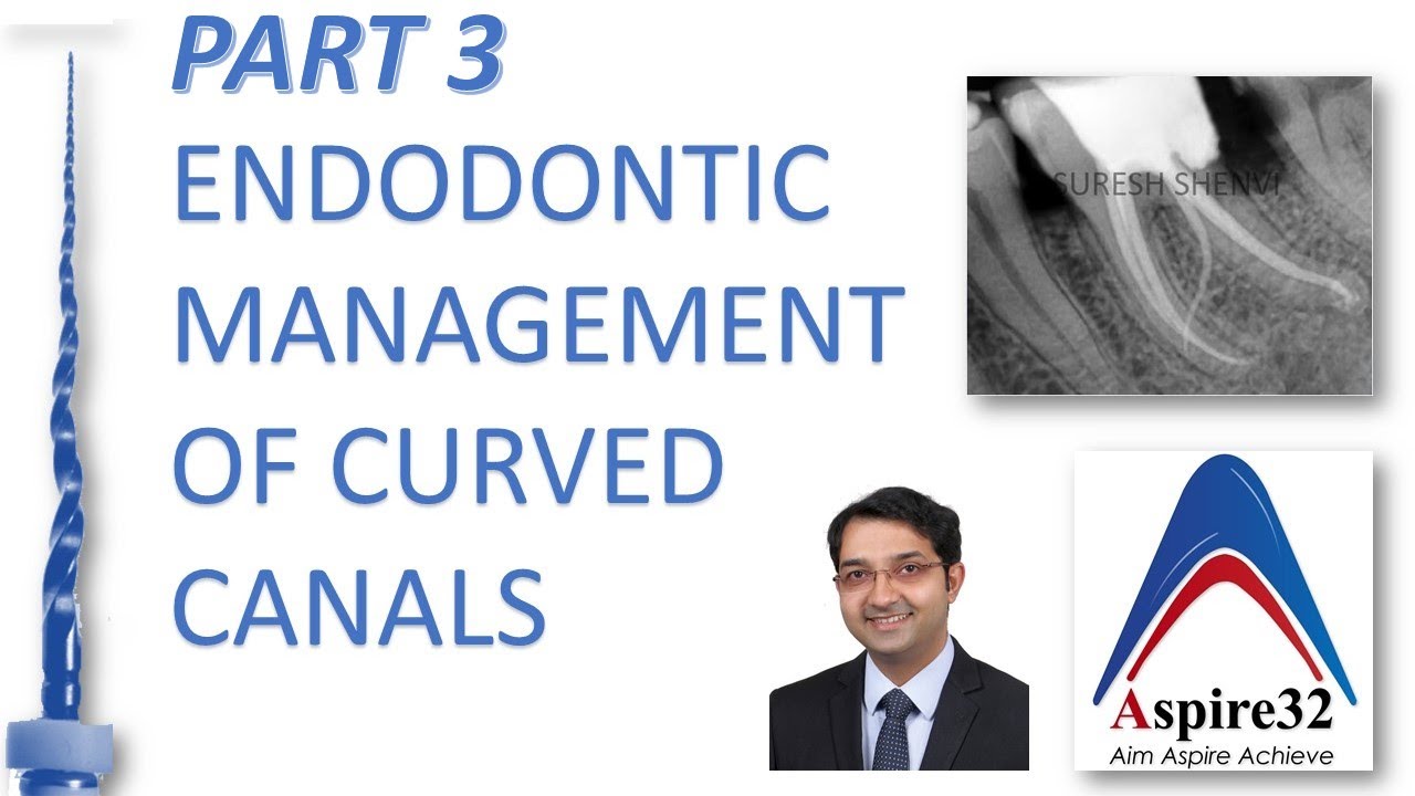 Endodontic management of curved canals - Part 3