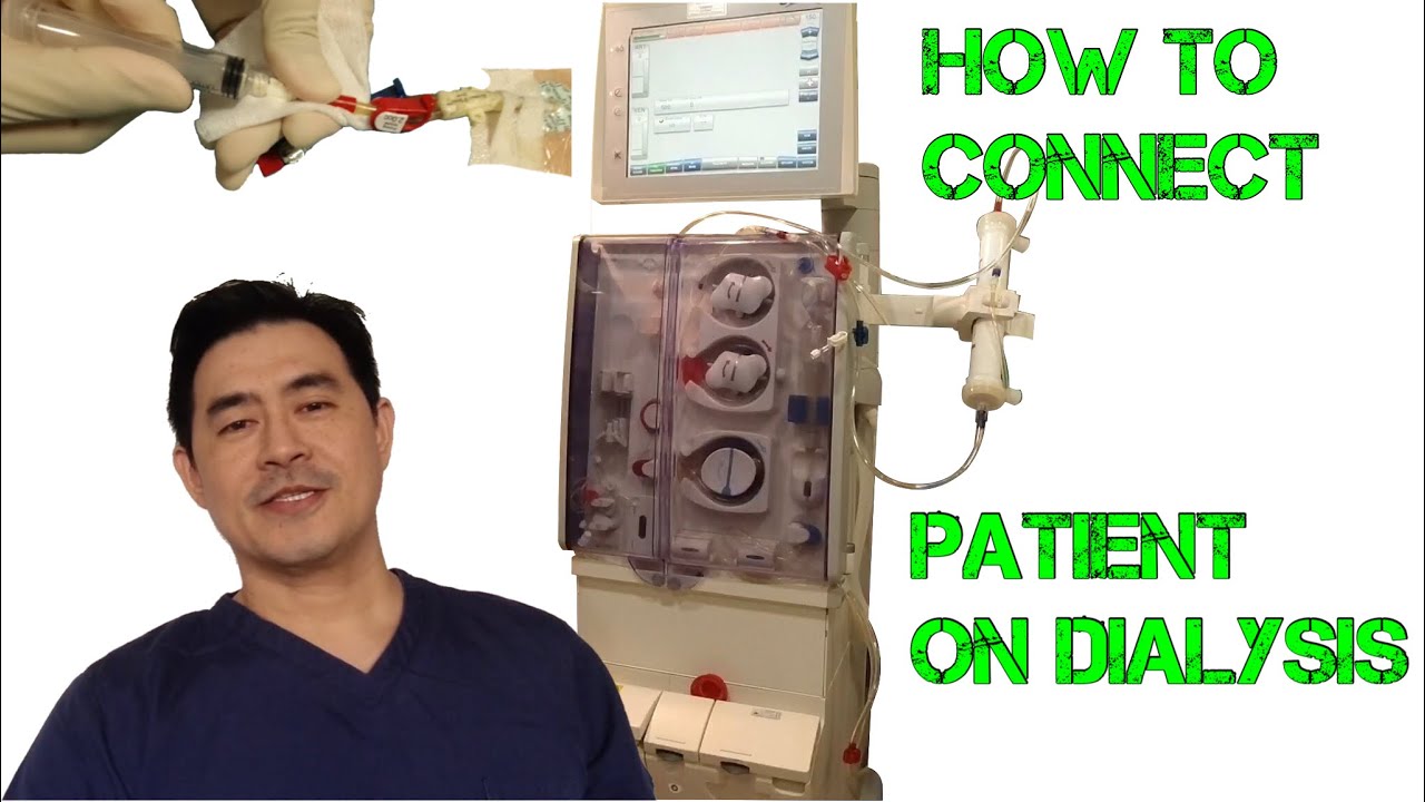HOW TO CONNECT PATIENT ON HEMODIALYSIS