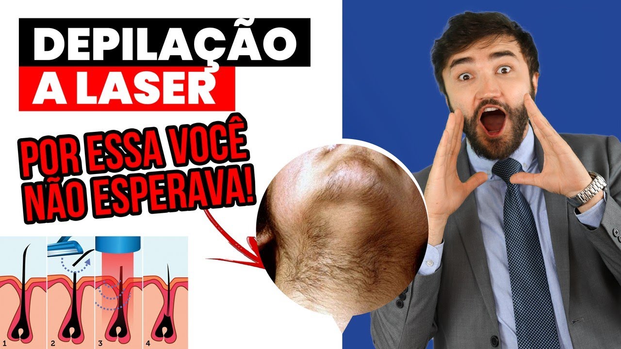 Condição rara faz PÊLOS CRESCEREM após depilação a laser!