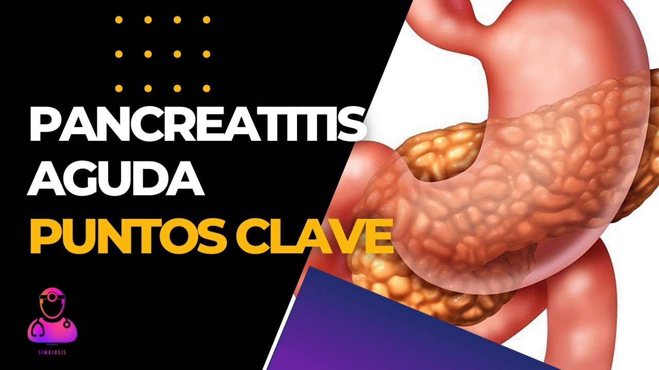 Pancreatitis Aguda. Aprendelo todo YA  | Medicina ¡Clases en 15 minutos!  #podcastmedico
