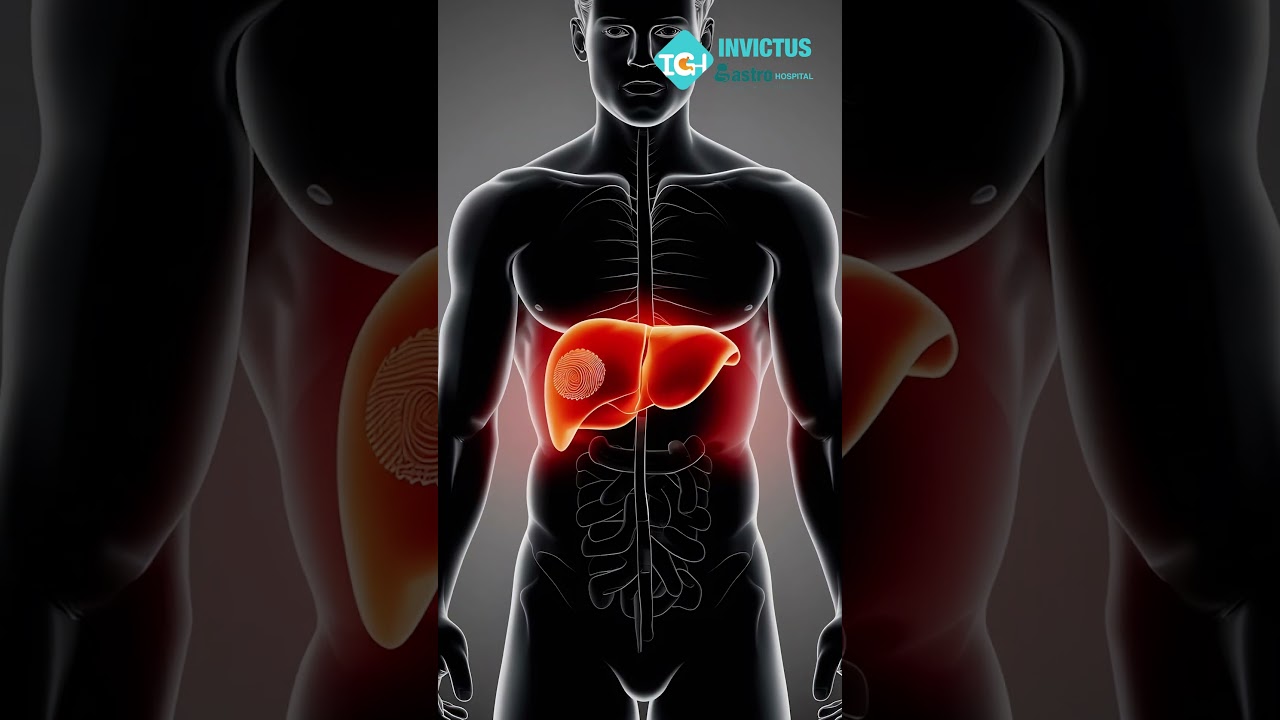 Fibroscan Test Explained | Liver Health Diagnosis and Treatment | Medical Technology