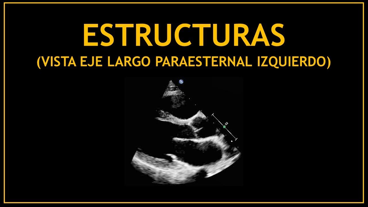 ESTRUCTURAS cardíacas - Ecocardiografia! (eje largo paraesternal izquierdo)