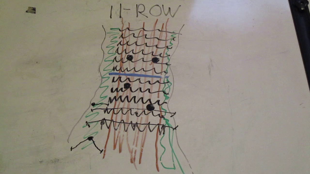 Militia Engineer Tasks- Constructing An 11-Row Wire Obstacle