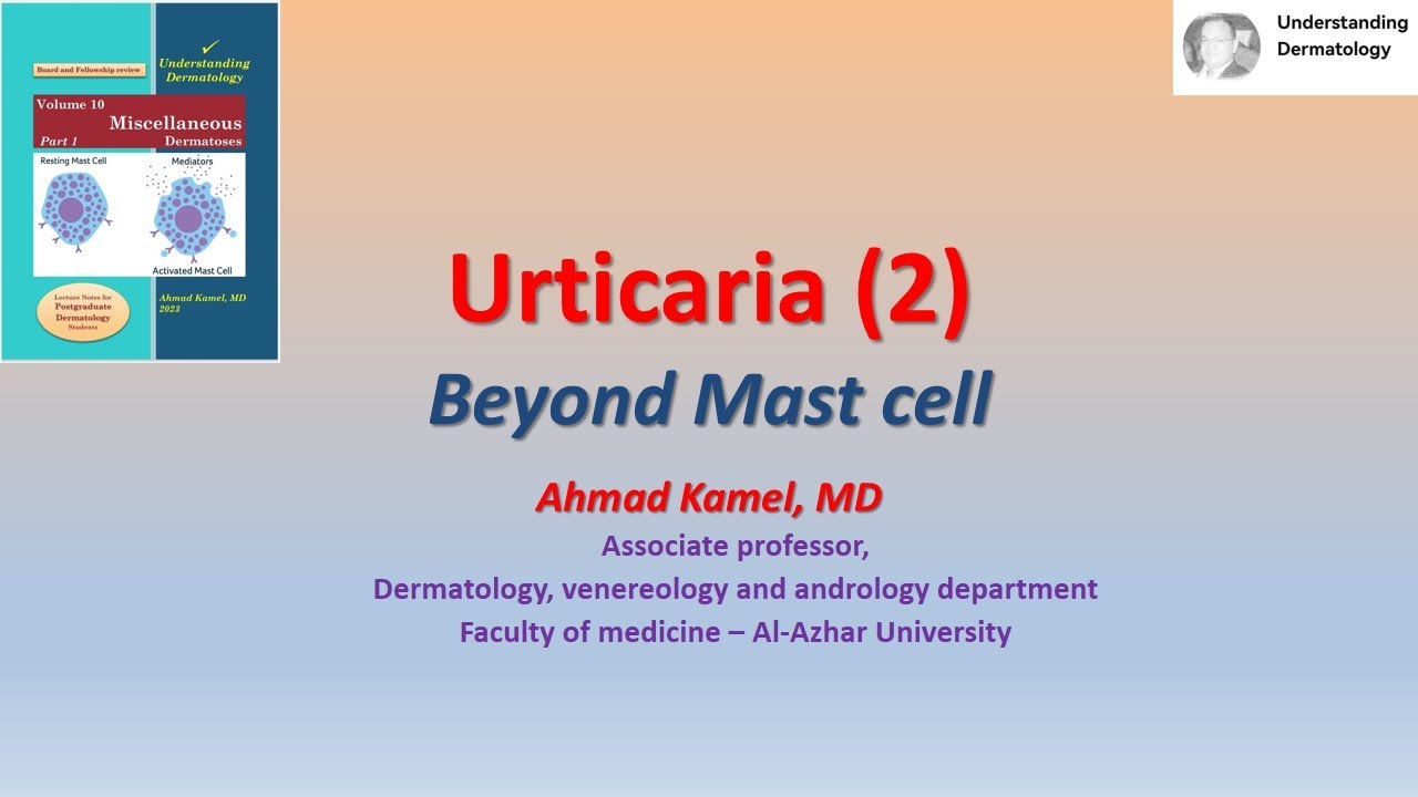 02 Urticaria Beyond mast cell