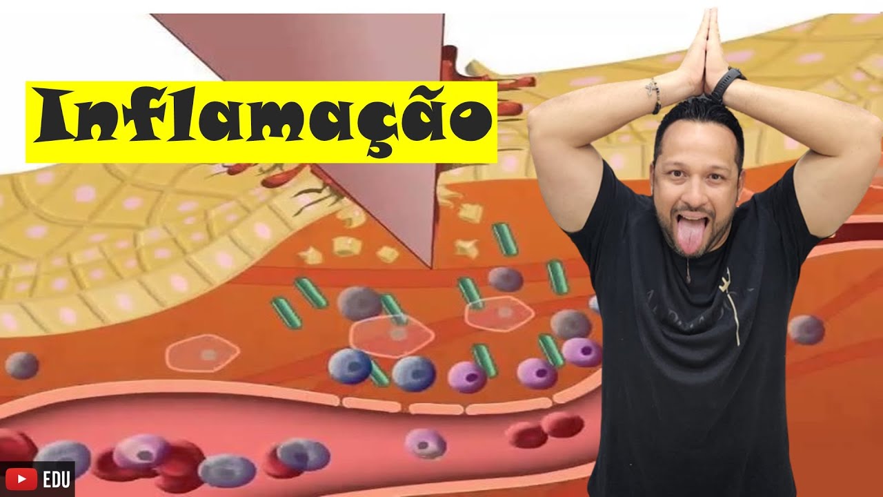 Inflamação - Conceito e Etapas - Sistema Imune - Fisiologia Humana