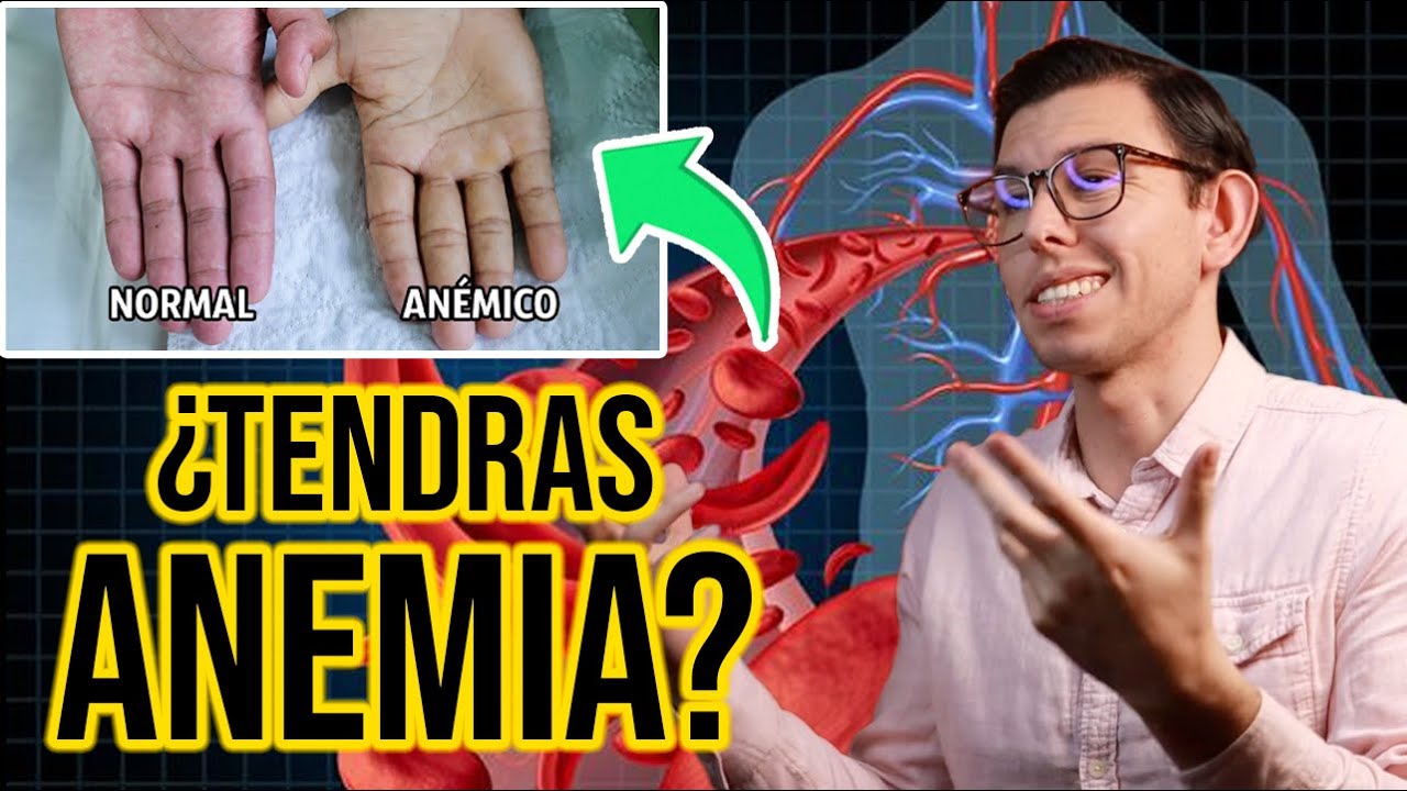 ¿Te SIENTES muy DEBIL? (Puede ser anemia) | DrPoloGuerrero