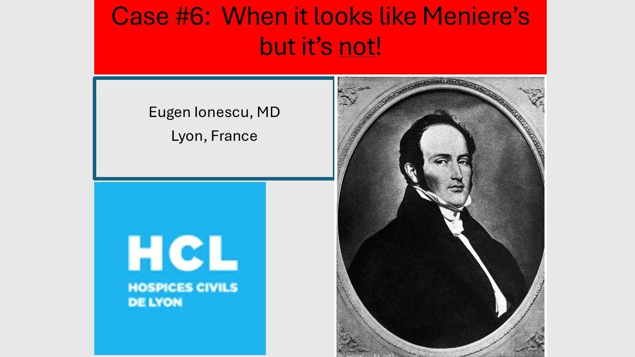 Case 6   When it looks like Meniere's but it's not