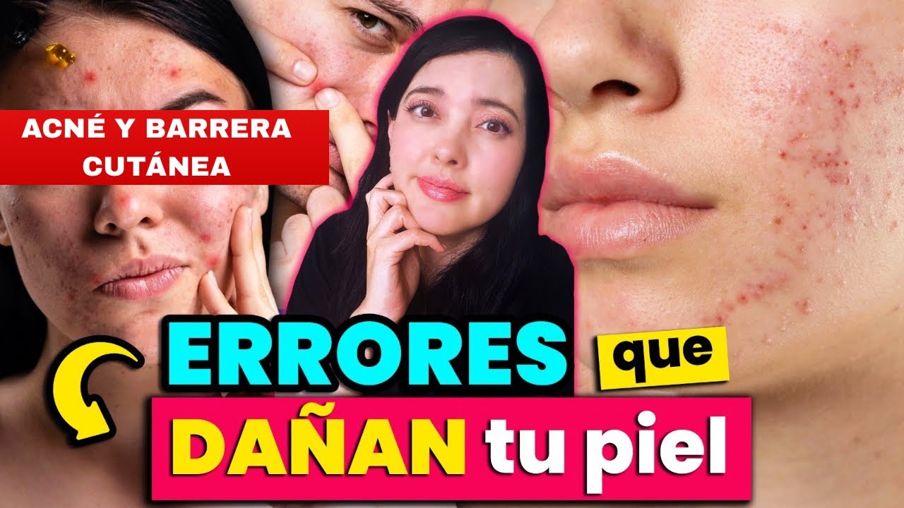 ¿ACNÉ REBELDE? Tal vez estás destruyendo tu barrera cutánea sin saberlo, aquí te explico ✨👩🏻‍⚕️