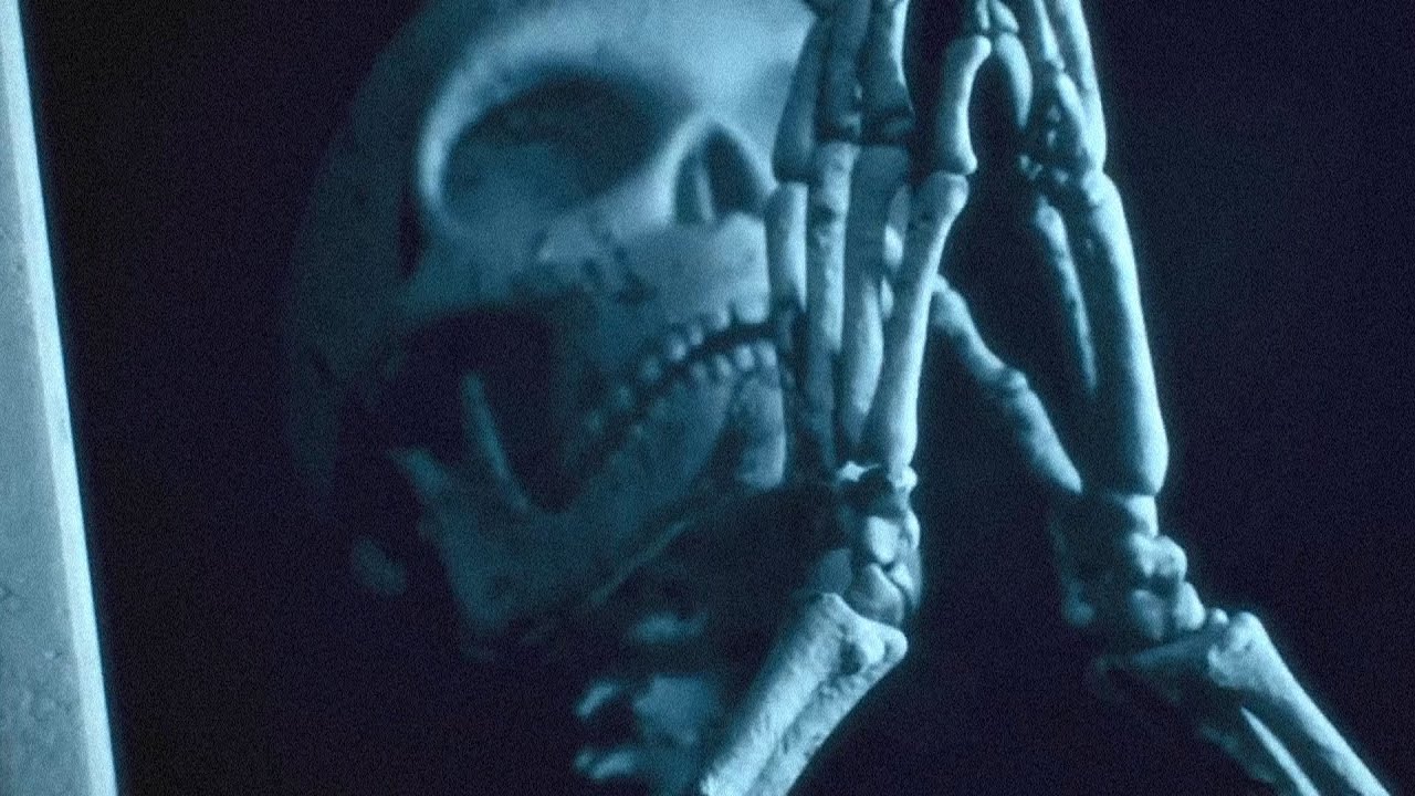 Bones - WaitingHere (Unreleased)