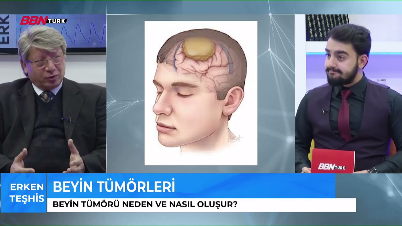 MEDOVA HASTANESİ PROF. DR. ERDAL KALKAN -  BEYİN TÜMÖRLERİ